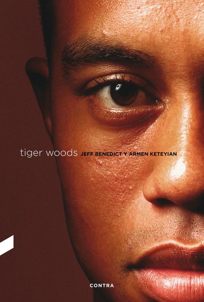 Tiger Woods. 